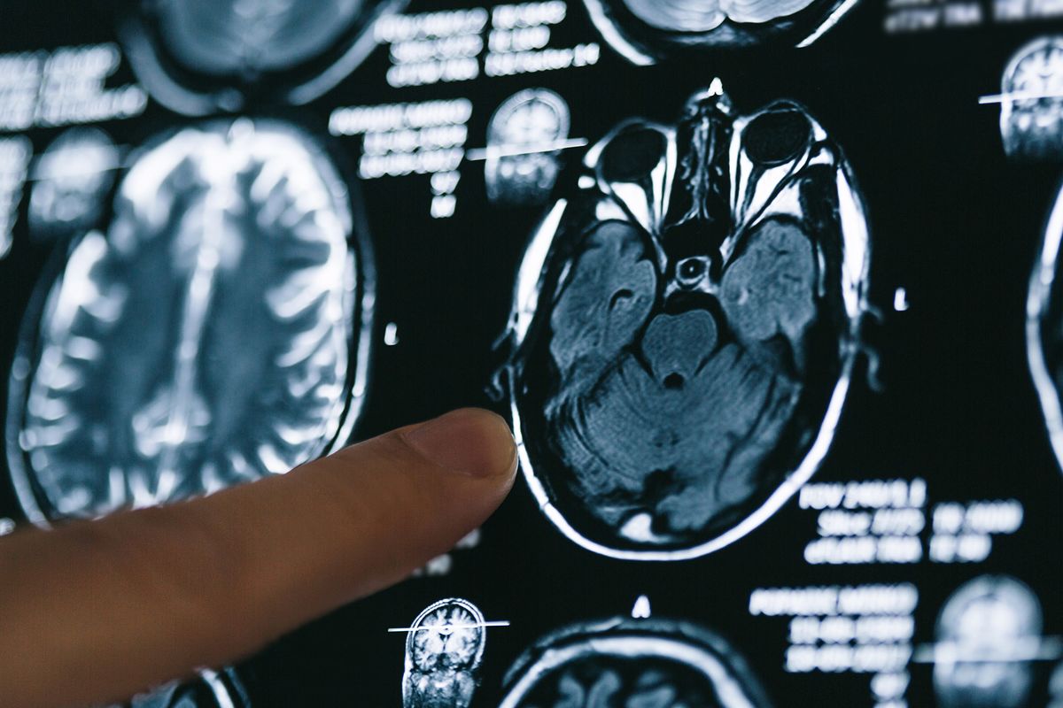 Magnetic Seeds Used to Heat and Kill Tumours Could Help Cancer Patients, Study Says