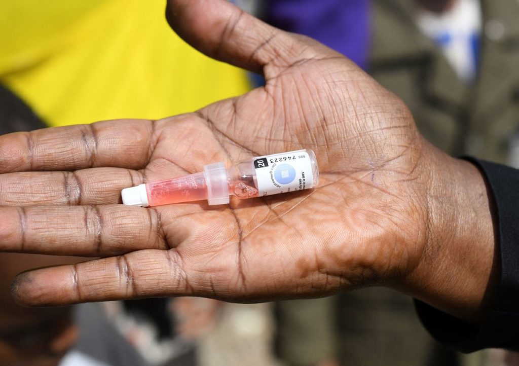 Polio Case Reported in N.Y., After a Decade With Zero in US
