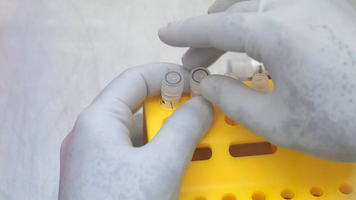 Siemens Healthineers gets India nod for Mpox test kit